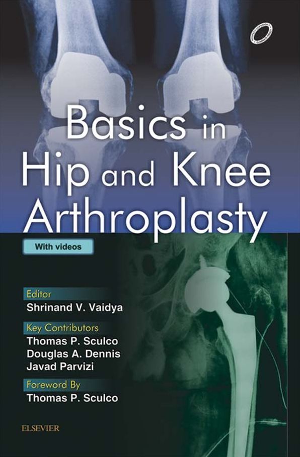 Basics in Hip and Knee Arthroplasty - E-book