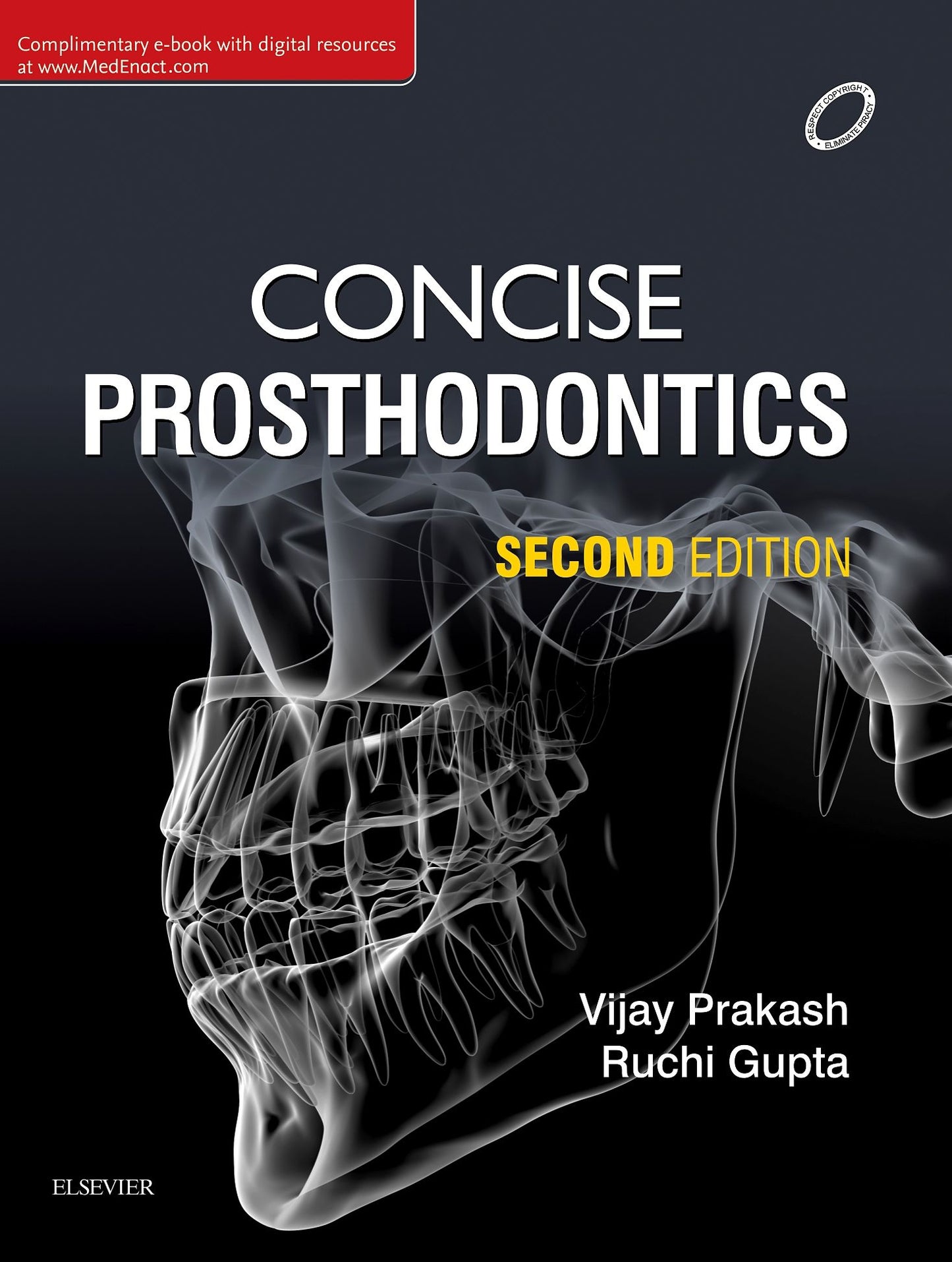 Concise Prosthodontics- E Book: Prep Manual for Undergraduates
