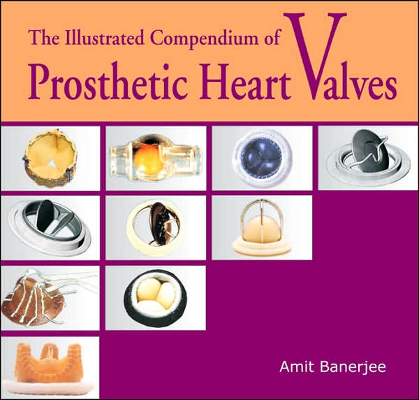 The Illustrated Compendium of Prosthetic Heart Valves