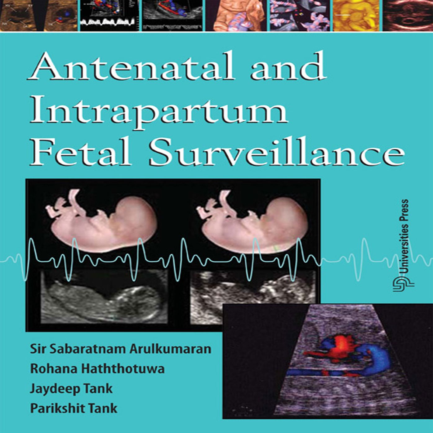 Antenatal and Intrapartum Fetal Surveilance