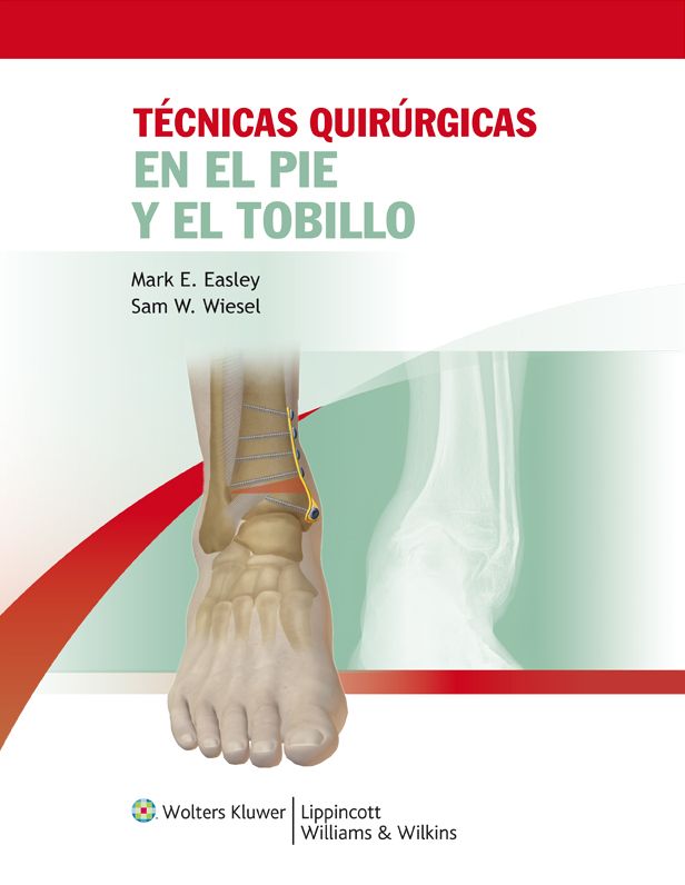 Tecnicas quirurgicas en pie y tobillo
