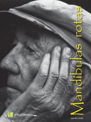 Mandíbulas Rotas