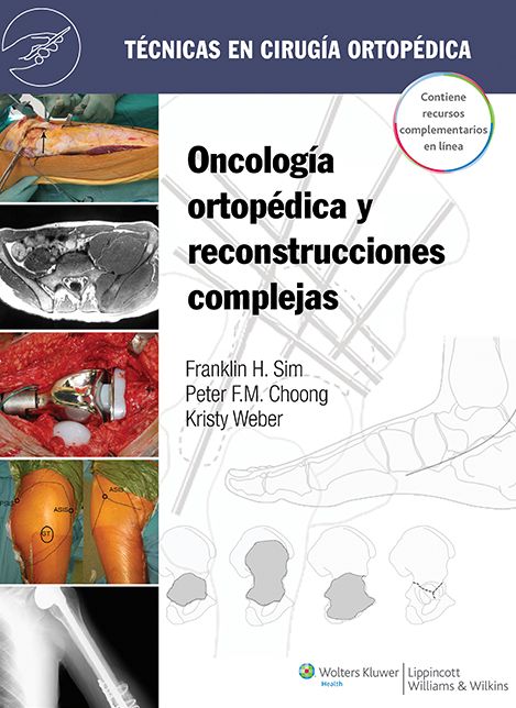 Tecnicas en cirugia ortopedica. Oncologia ortopedica y reconstrucciones complejas