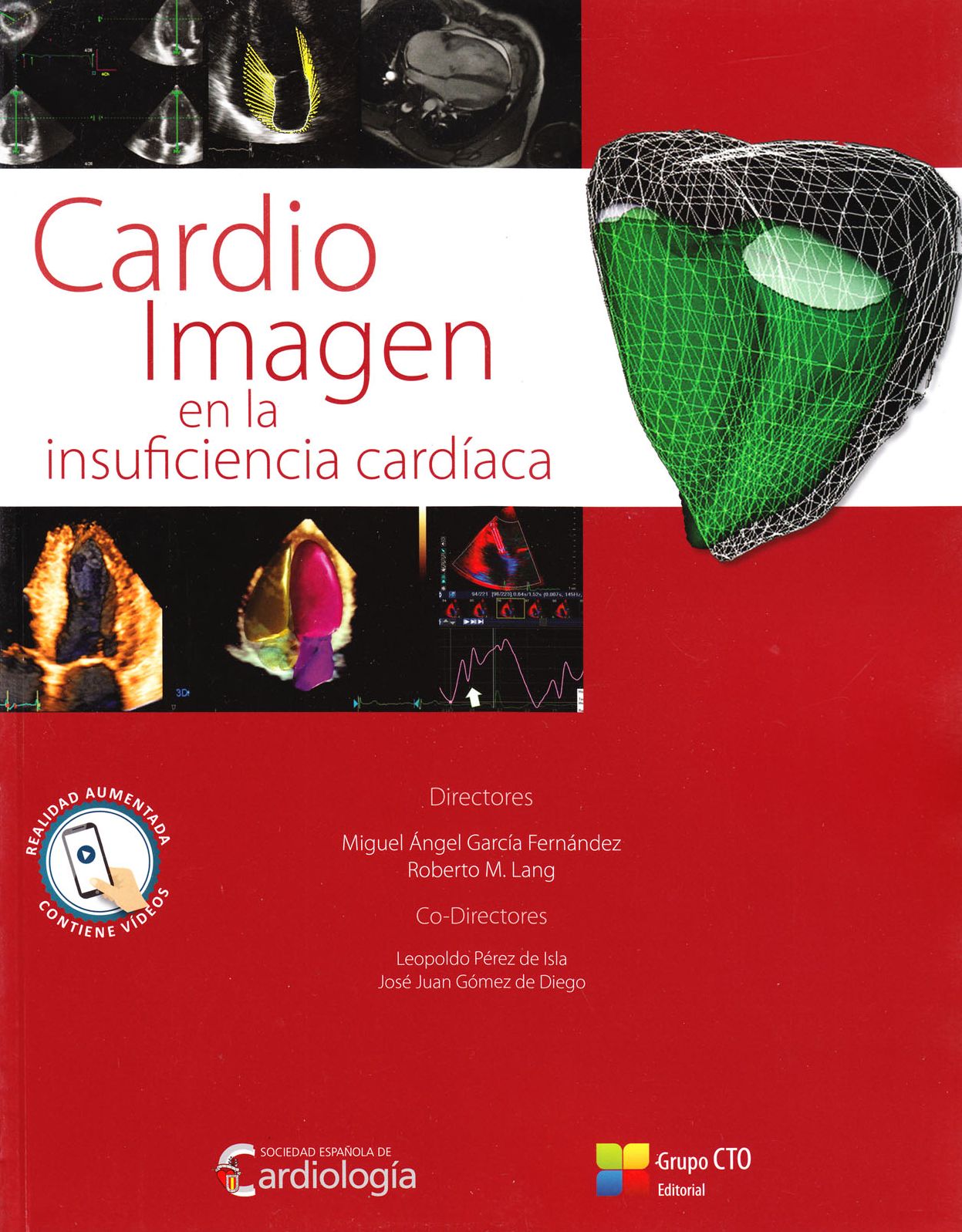 Cardio Imagen en la Insuficiencia Cardiaca
