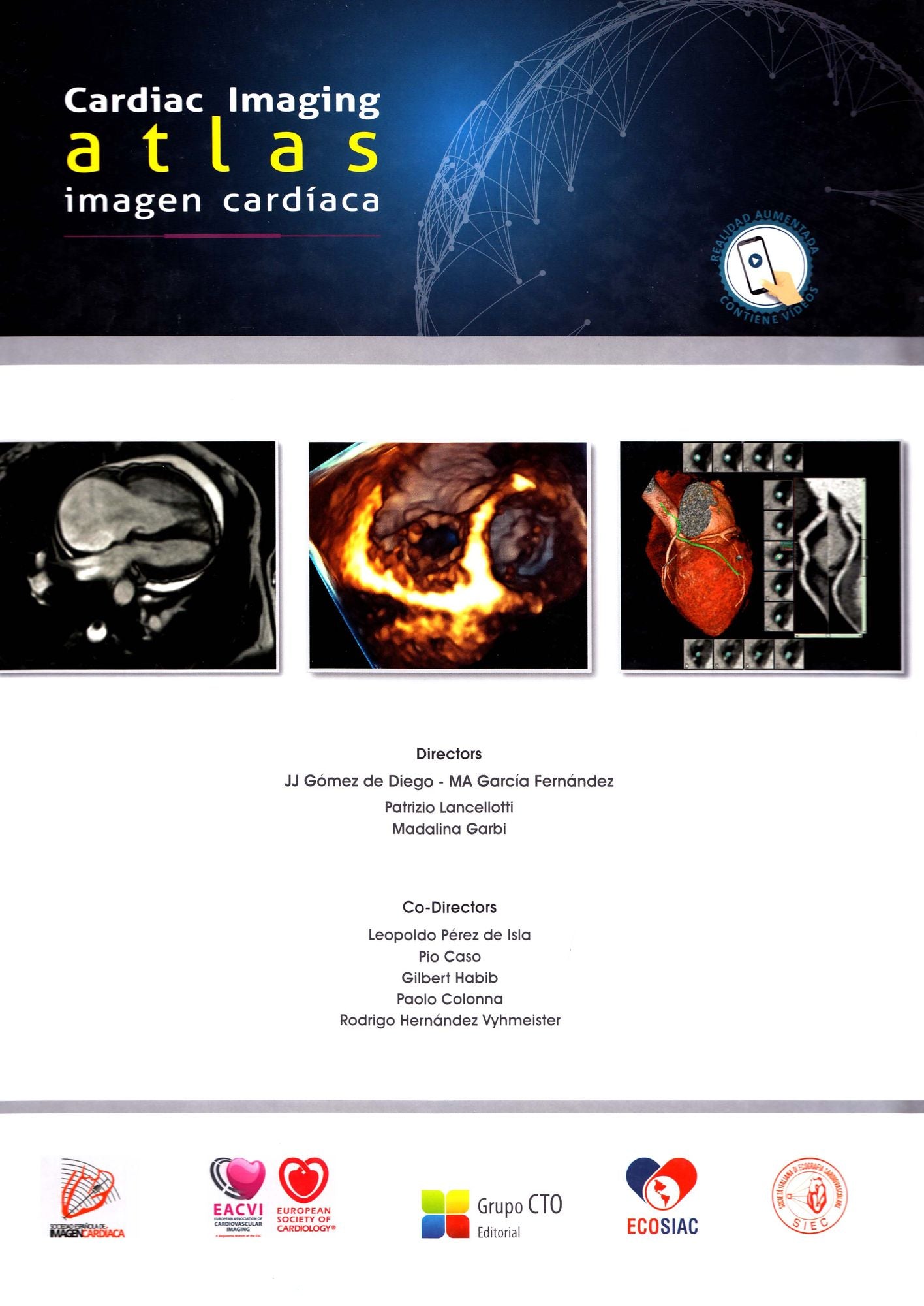Cardiac Imaging Atlas - Imagen Cardiaca