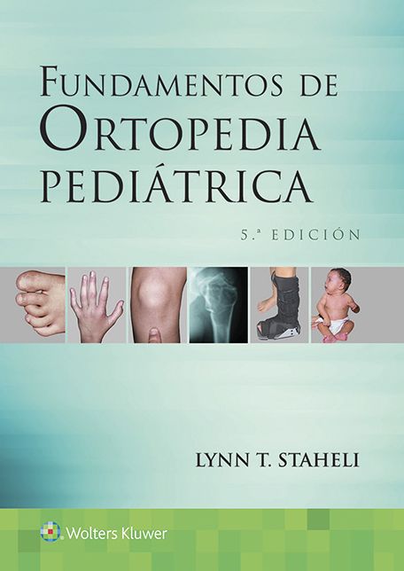 Fundamentos de ortopedia pediatrica
