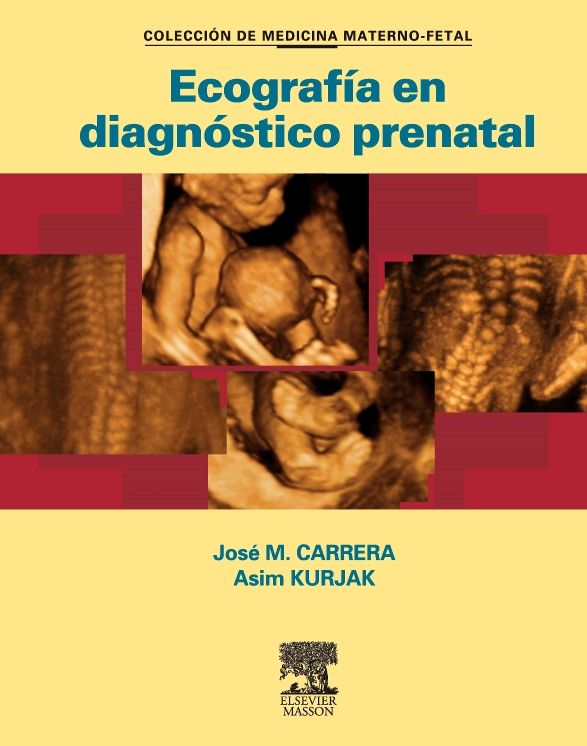 Ecografía en diagnóstico prenatal