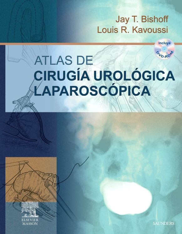 Atlas de cirugía urológica laparoscópica