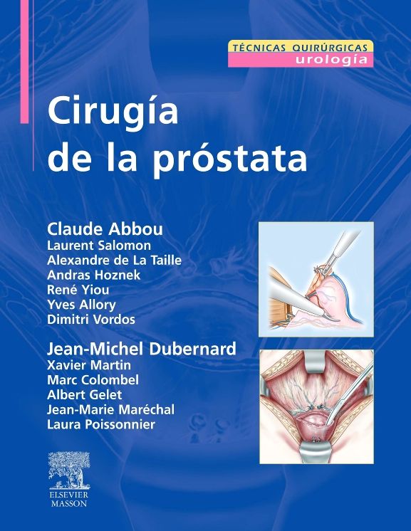 Cirugía de la próstata