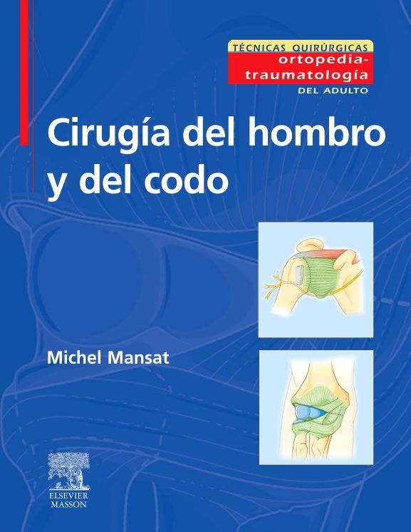 Cirugía del hombro y del codo