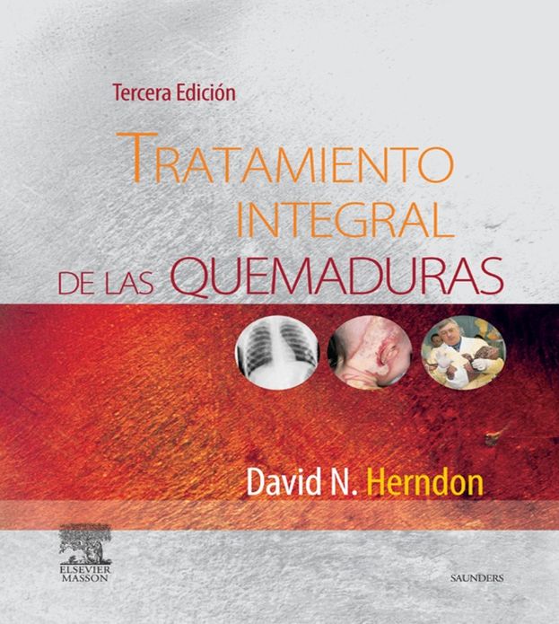 Tratamiento integral de las quemaduras
