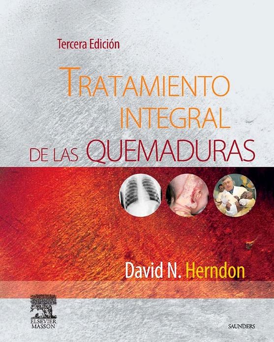 Tratamiento integral de las quemaduras