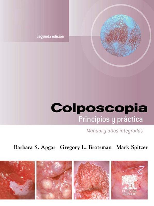 Colposcopia. Principios y práctica: Manual y atlas integrados