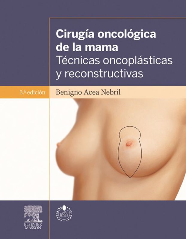 Cirugía oncológica de la mama + acceso web: Técnicas oncoplásticas y reconstructivas