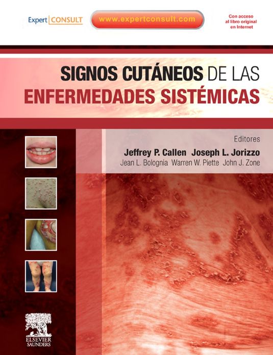 Signos cutáneos de las enfermedades sistémicas + ExpertConsult