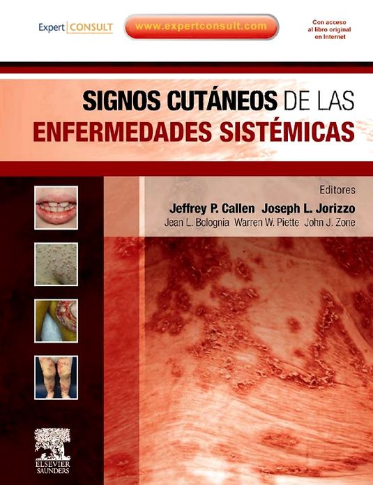 Signos cutáneos de las enfermedades sistémicas + ExpertConsult