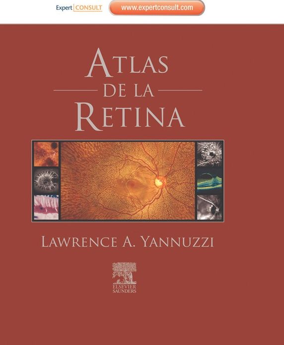 Atlas de la retina + ExpertConsult