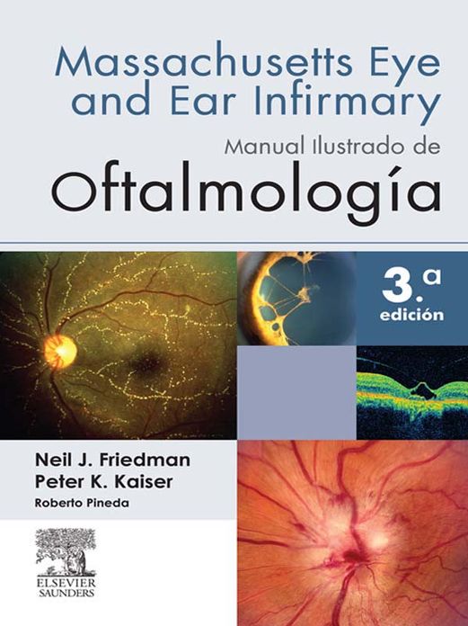 Manual ilustrado de Oftalmología