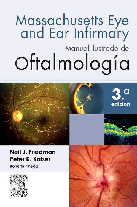 Manual ilustrado de Oftalmología
