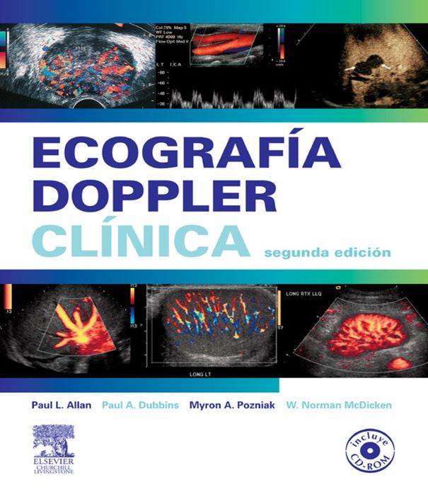 Ecografía Doppler clínica