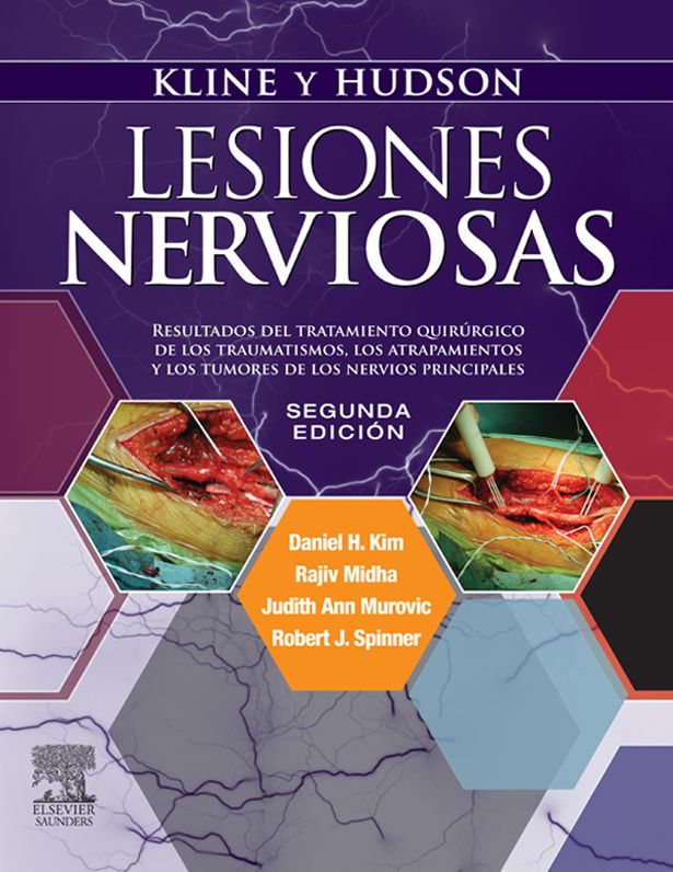 Kline y Hudson. Lesiones nerviosas: Resultados del tratamiento quirúrgico de los traumatismos, los atrapamientos y los tumores de los nervios principales