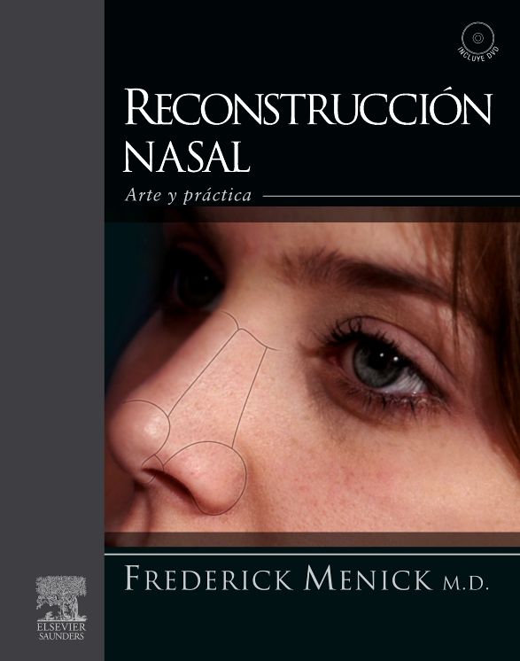 Reconstrucción nasal: Arte y práctica