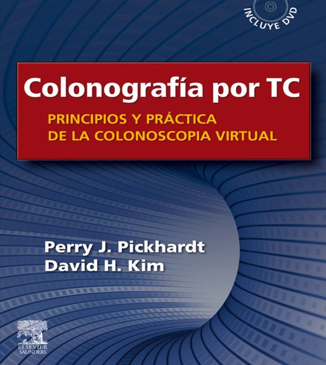 Colonografía por TC: Principios y práctica de la colonoscopia virtual: Principios y práctica de la colonoscopia virtual