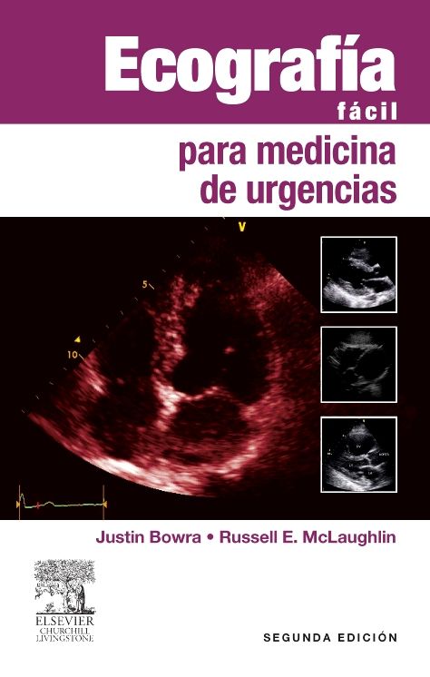 Ecografía fácil para medicina de urgencias