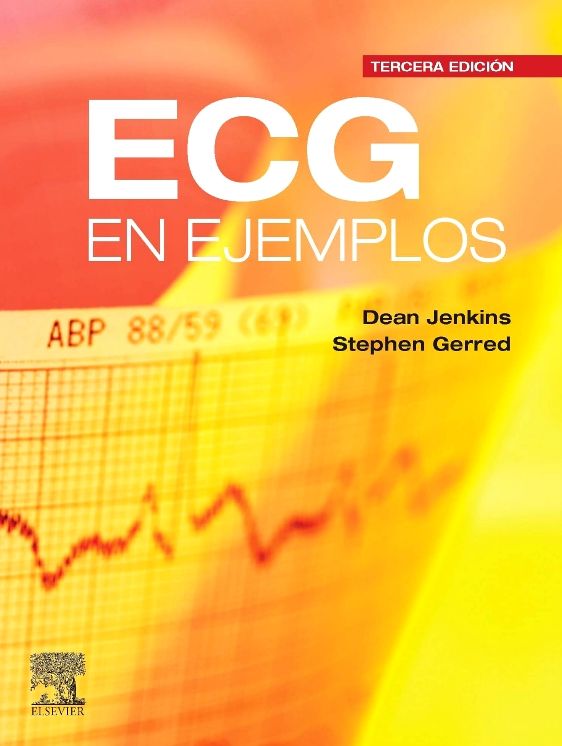 ECG en ejemplos