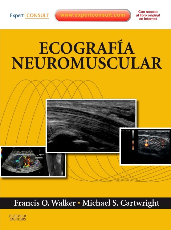 Ecografía neuromuscular + ExpertConsult