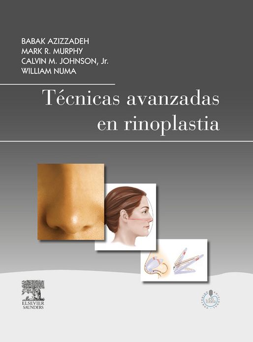 Técnicas avanzadas en rinoplastia + StudentConsult en español