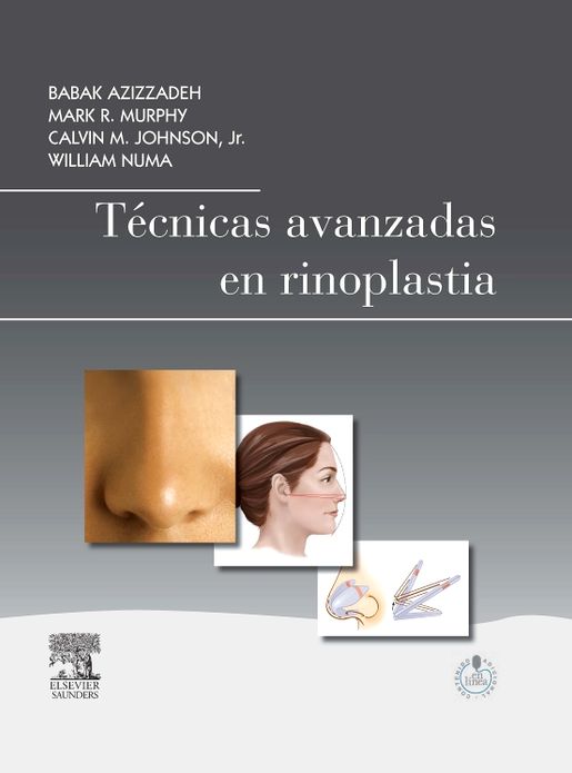 Técnicas avanzadas en rinoplastia + StudentConsult en español