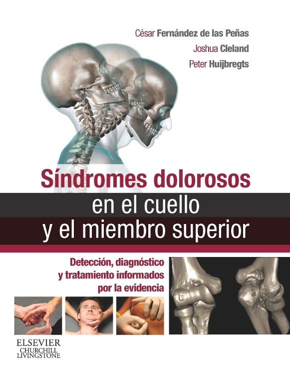 Síndromes dolorosos en el cuello y el miembro superior: Detección, diagnóstico y tratamiento informados por la evidencia