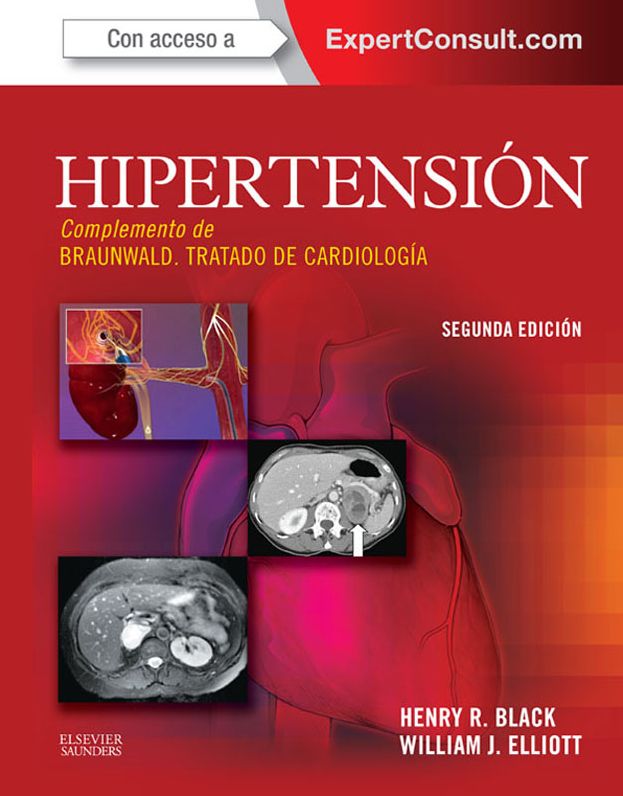 Hipertensión + ExpertConsult
