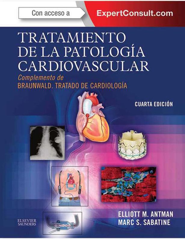 Tratamiento de la patología cardiovascular + ExpertConsult: Complemento de Braunwald. Tratado de Cardiología