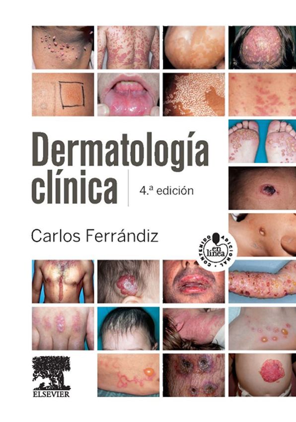 Dermatología clínica + StudentConsult en español