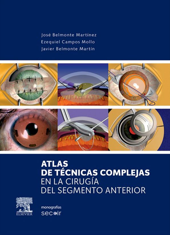 Atlas de técnicas complejas en la cirugía del segmento anterior