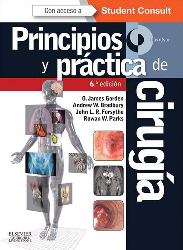 Davidson. Principios y práctica de cirugía + StudentConsult