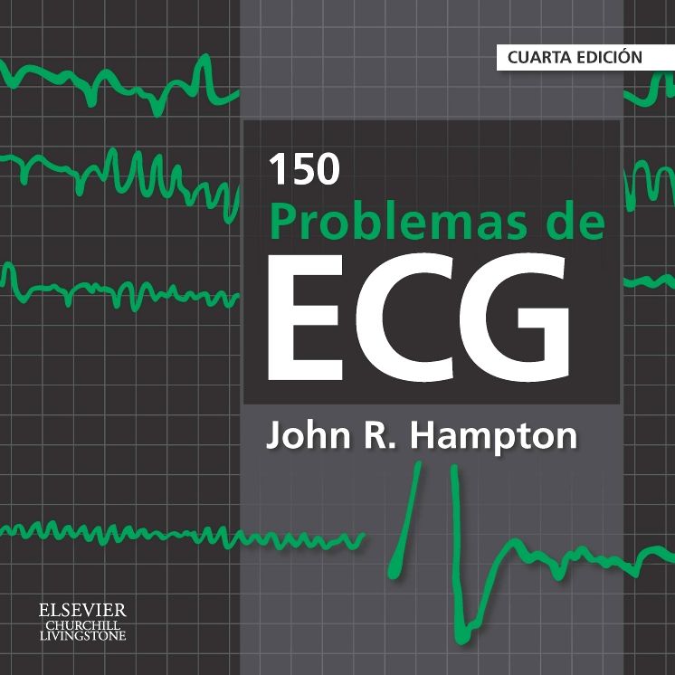 150 problemas de ECG