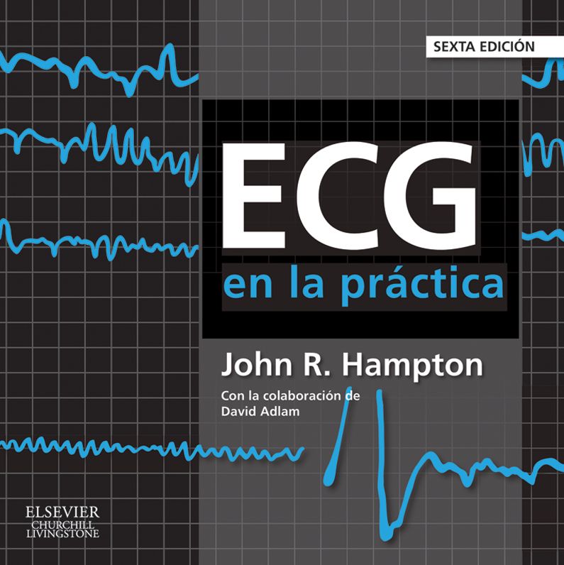 ECG en la práctica