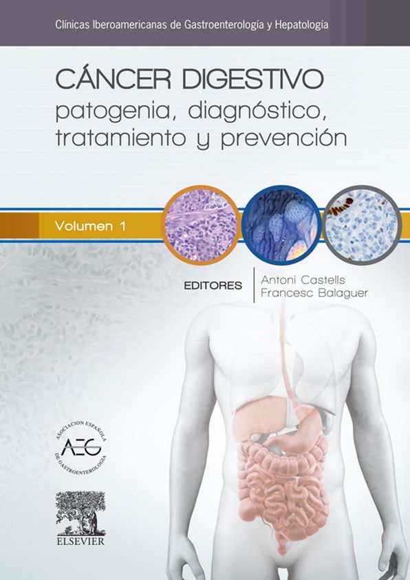 Cáncer digestivo: patogenia, diagnóstico, tratamiento y prevención: Clínicas Iberoamericanas de Gastroenterología y Hepatología vol. 1