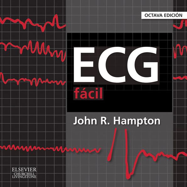 ECG fácil