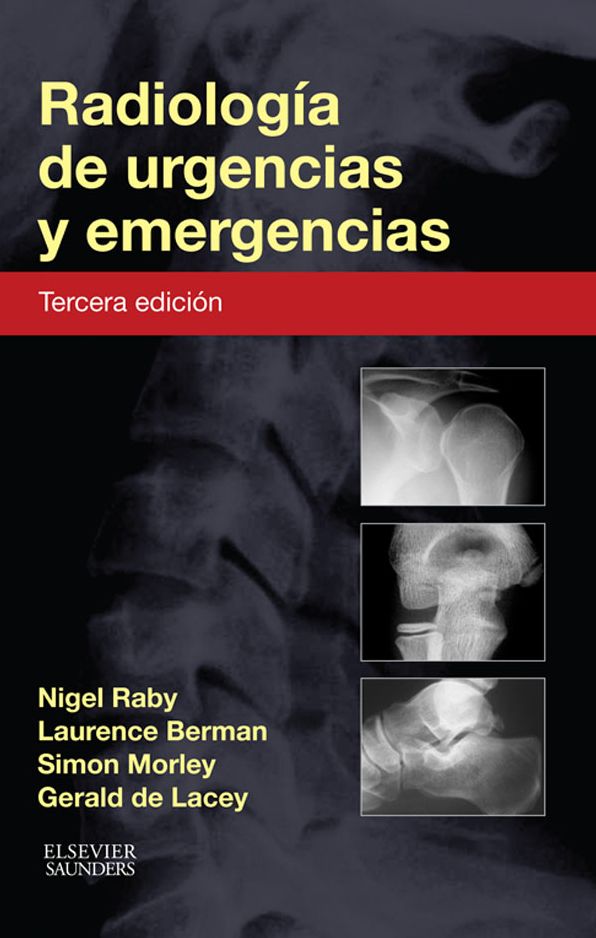 Radiología de urgencias y emergencias