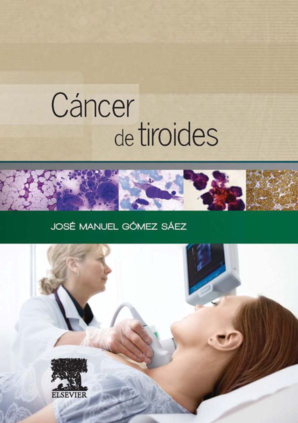 Cáncer de tiroides: Presente y futuro