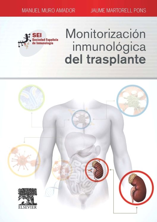 Monitorización inmunológica del trasplante: Sociedad Española de Inmunología