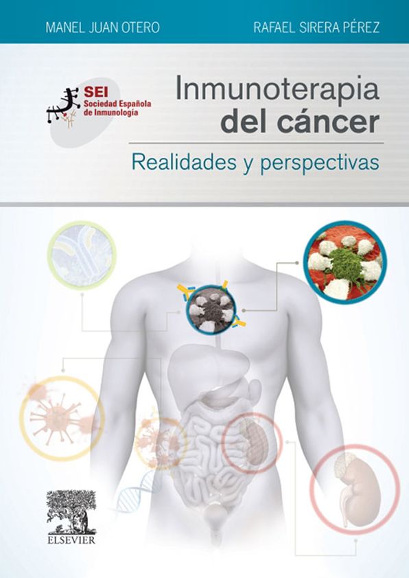 Inmunoterapia del cáncer. Realidades y perspectivas: Sociedad Española de Inmunología