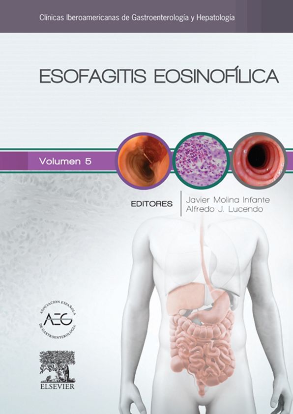 Esofagitis eosinofílica: Clínicas Iberoamericanas de Gastroenterología y Hepatología vol. 5