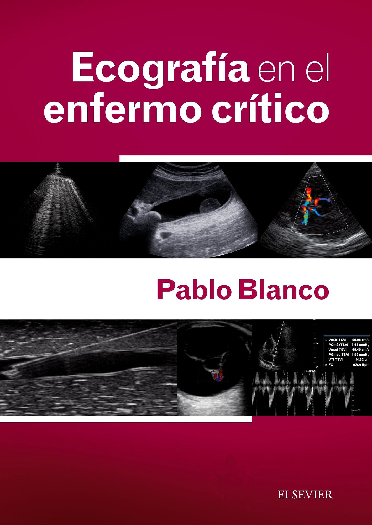 Ecografía en el enfermo crítico + acceso web