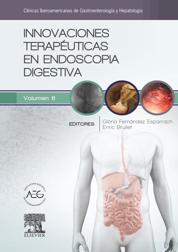 Innovaciones terapéuticas en endoscopia digestiva: Clínicas Iberoamericanas de Gastroenterología y Hepatología vol. 6