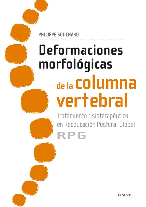 Deformaciones morfológicas de la columna vertebral: Tratamiento fisioterapéutico en reeducación postural global RPG